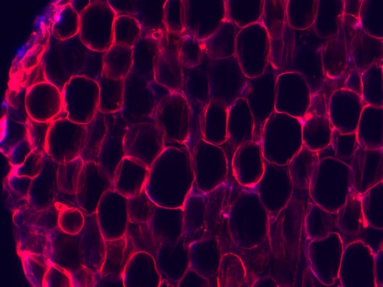 3D眼睑皮肤模型3D脂肪打印