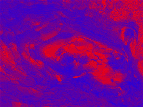 3D 自然老化皮肤模型 3D色素皮肤模型