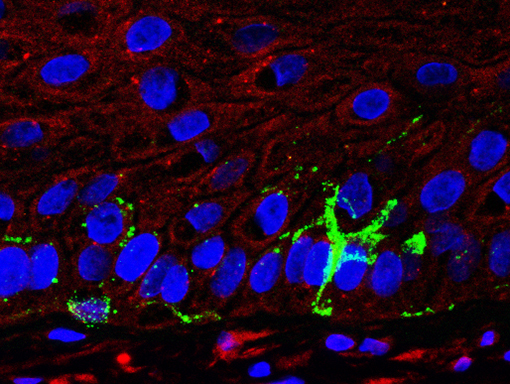 3D 自然老化皮肤模型 3D色素皮肤模型