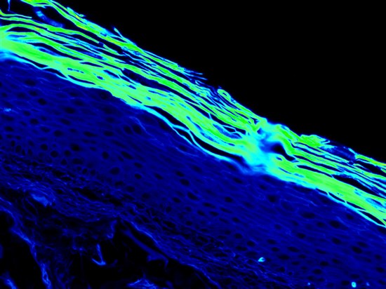 3D 自然老化皮肤模型 3D色素皮肤模型