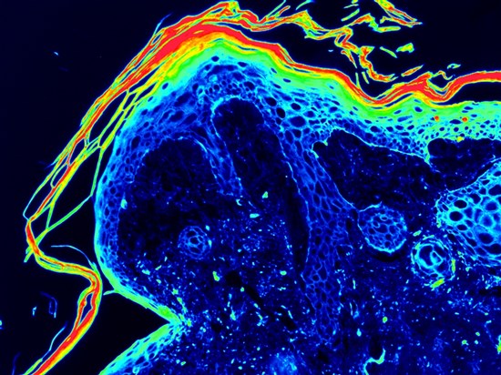 3D眼睑皮肤模型3D脂肪打印