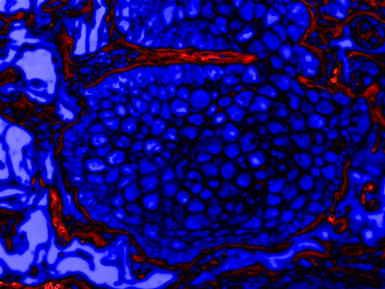 3D眼睑皮肤模型3D脂肪打印