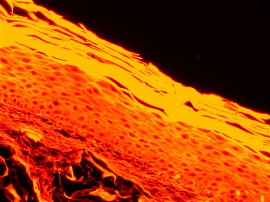 术中打印篇3D伤口愈合模型篇