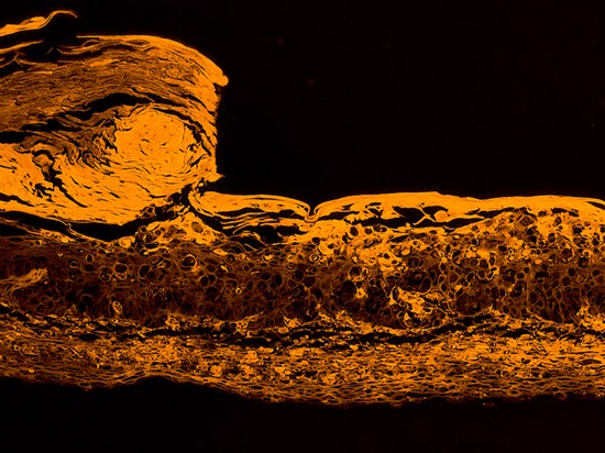 术中打印篇3D伤口愈合模型篇