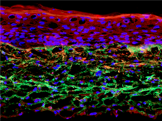 3D眼睑皮肤模型3D脂肪打印